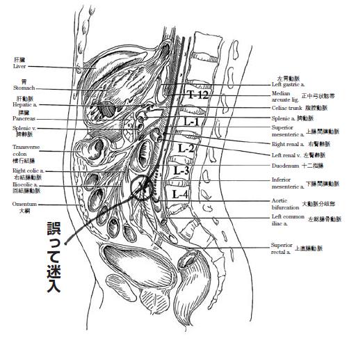 人体側面の解剖図と誤って迷入した箇所